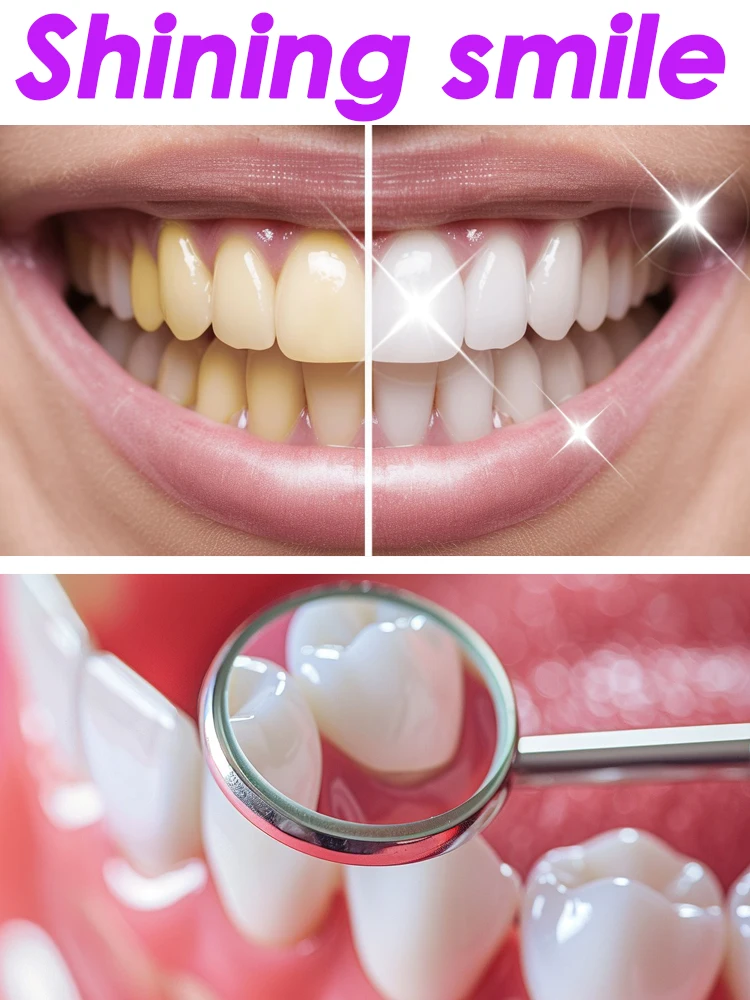 GlorySmile Teeth Whitening Fruity Toothpaste Products Dental Plaque Tartar Fluorosis Cleaning Preventing Tooth Decay Oral Care