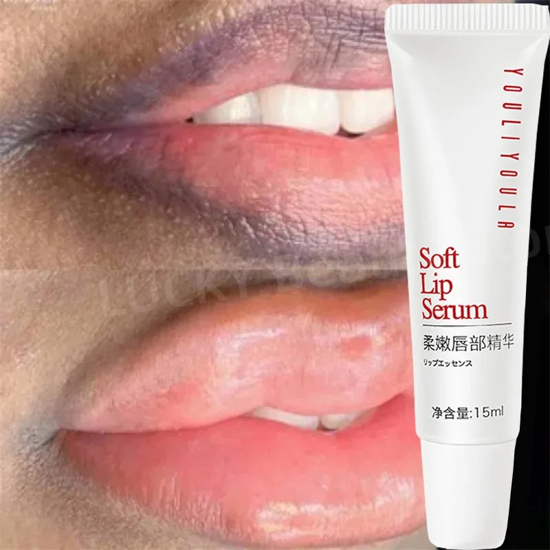 

Lips Pink Fresh Lightening Bleaching Cream Treatment Remove Dark Smoke Lips Lip Balm Whitening Moisturizer Nourishing Essence