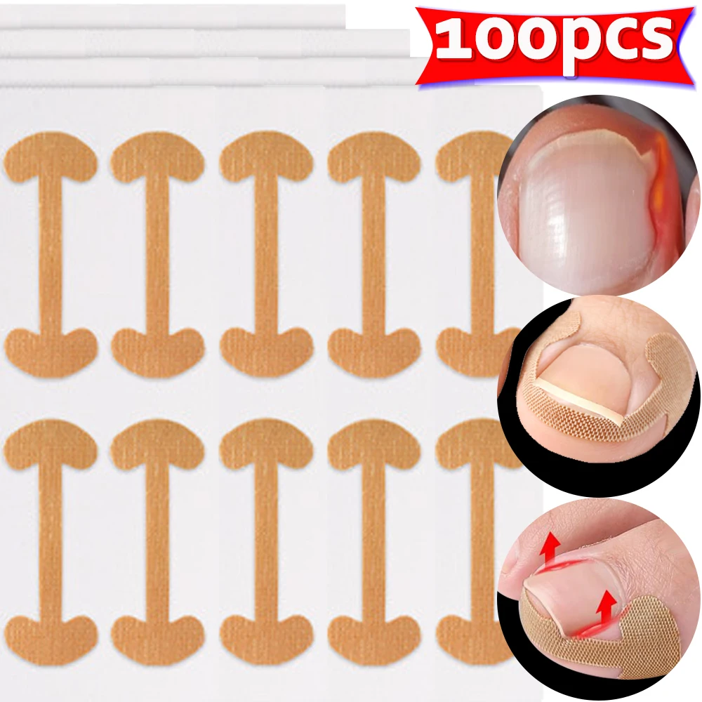 Bandes correctrices pour ongles incarnés, 100 pièces, adhérence durable, autocollants imperméables, élasticité, soins des orteils, outils de pédicure