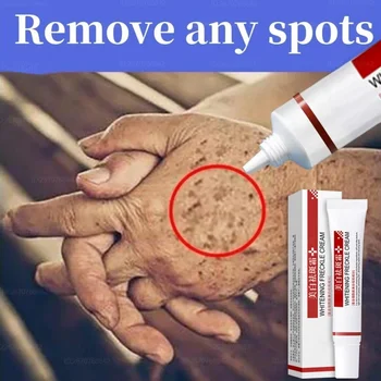 Etkili beyazlatmak çil krem koyu nokta kaldırmak melazma solmaya Melanin anti-pigmentasyon geliştirmek Dullness hızlı aydınlatmak yüz yeni