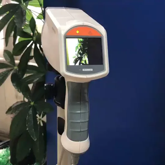 OEM/ODM Digital Colposcope  for Early Cervical Cancer Detection