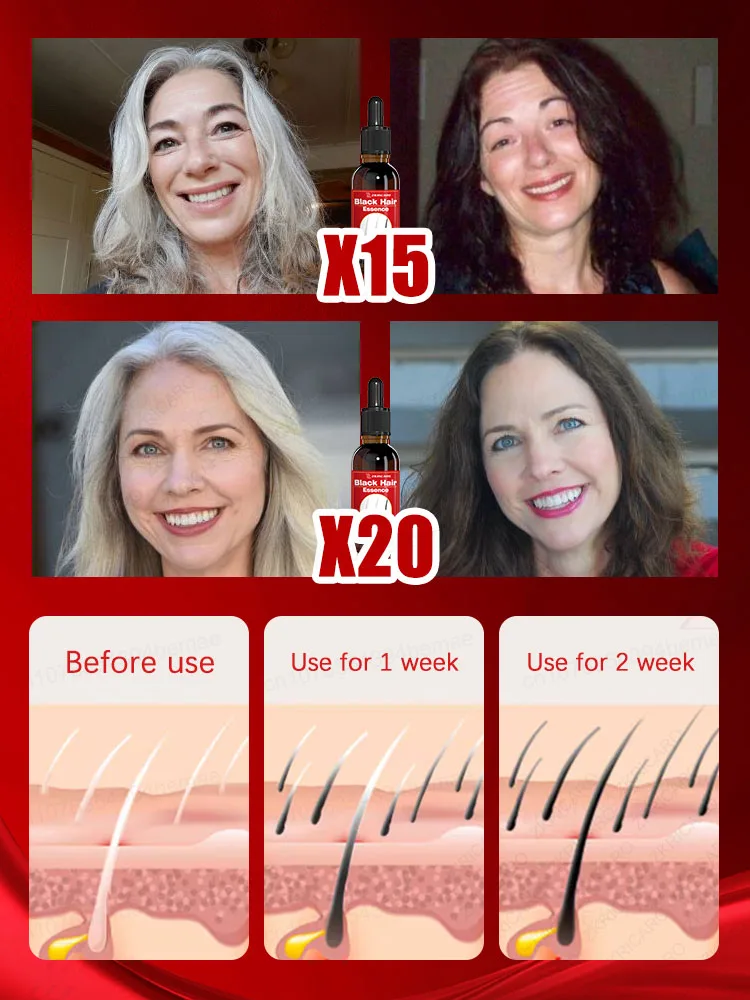 قل وداعاً للشعر الرمادي مما يجعلك تبدو أكبر، ويستعيد شعرك الأسود الطبيعي في 7 أيام. #3