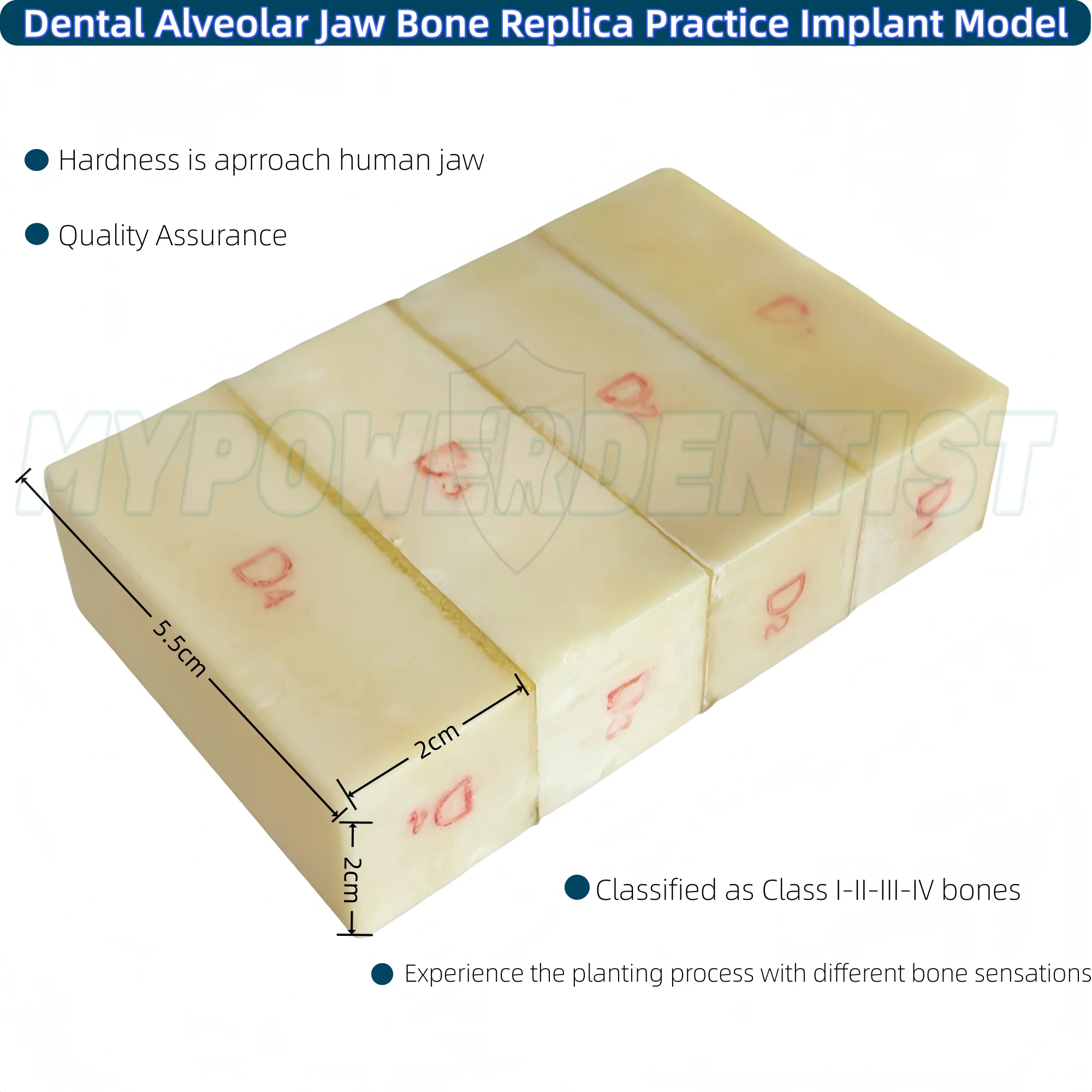 

Dental Alveolar Jaw Bone Replica Practice Study Model Implant Block Resin Class 1 2 3 4