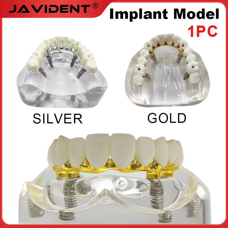 

1Pcs Dental Implant Restoration Bridge Model Four Implant Abutments Dental Demonstration Teaching and Patient Communication