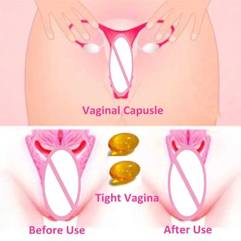 Cápsulas apertadas das mulheres, 10 Cápsulas