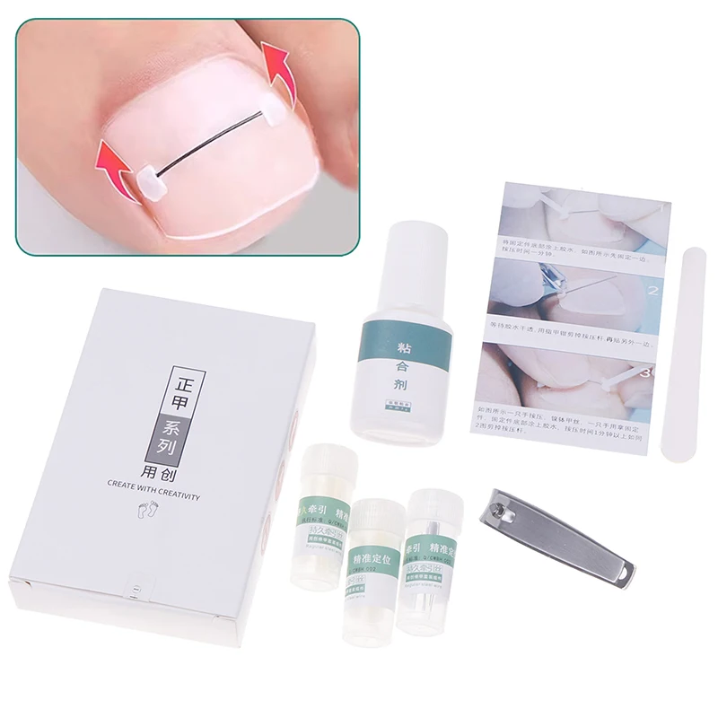 คุด Toenail Corrector เครื่องมือ Pedicure Recover ฝัง Toe Nail Treatment Professional คุด Toenail Straightening คลิปรั้ง