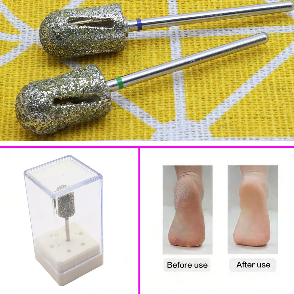 1Pc 10mm High End Diamond Pedicure Nail Bit - 60# 120#, Carbon Steel with Diamond Coating, Easy & Sharp Sanding Cap for Electric