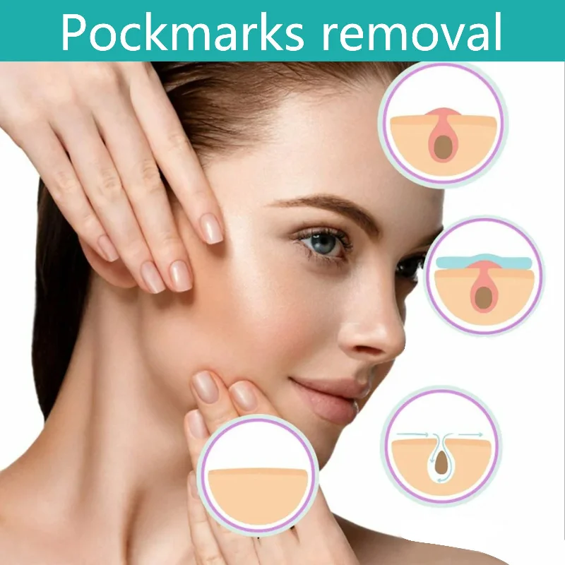 pockmarks Removal Face Massage Roller Facial Lifting Firming Skin Fading Fine Lines Acne Facial Massage Roller Skin Care Tools