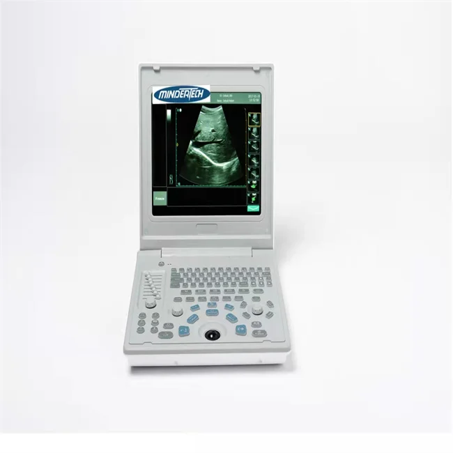 Hot Selling Medical Scanner 3d Ultrasound Machine Portable Ultrasound Scan Machine Animal Ultrasound Machine