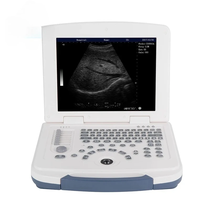 المعدات البيطرية MU10 Sonoscape آلة الموجات فوق الصوتية البيطرية