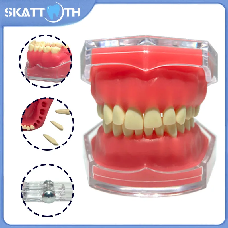 Dental Teeth Model With Removable Teeth Soft Gum Tooth Extraction Pratice Model Dentist Teach Study Patient Education Demo Model