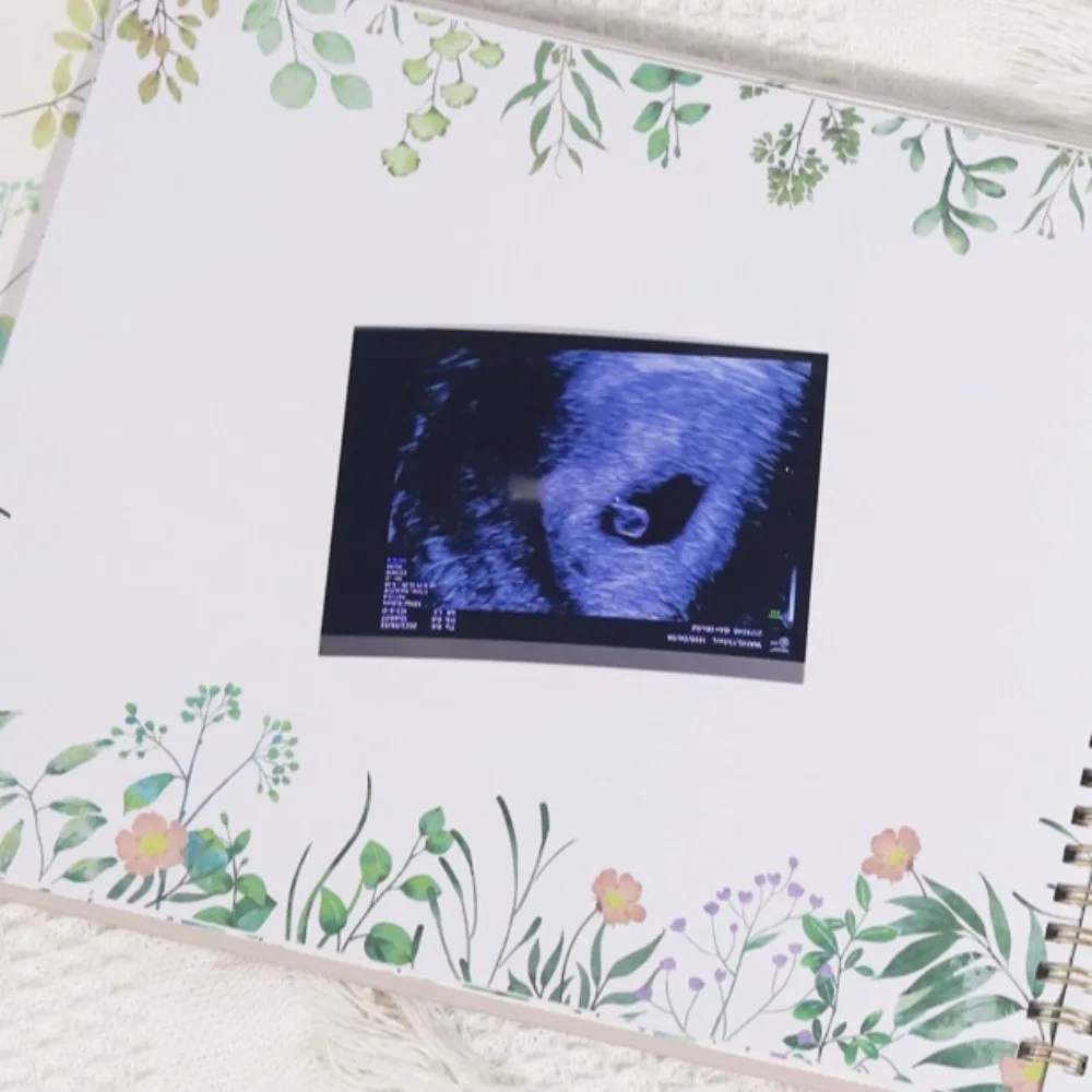 

A4 Pregnancy Journey Memory Books Keepsake Books Photo Collection Pregnancy Examination Records Notepad Diary