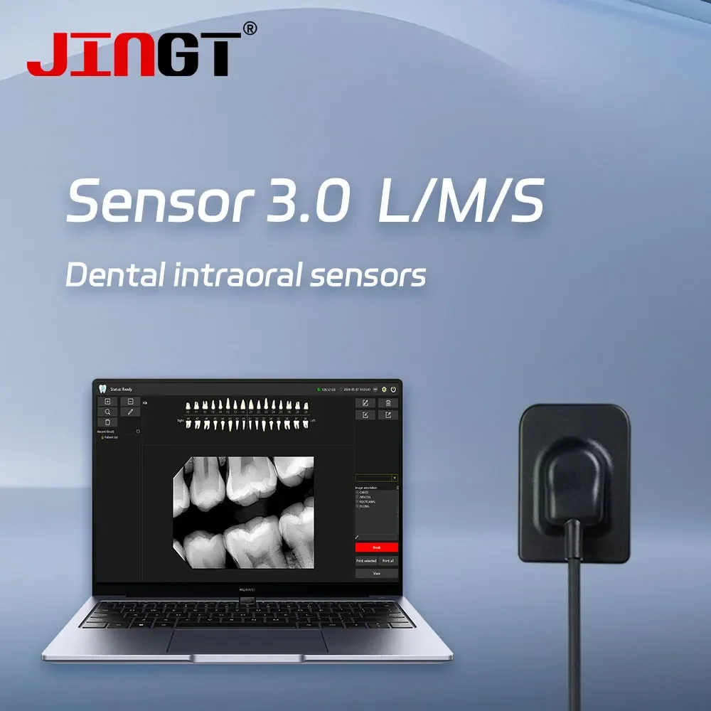 JINGT SENSOR 3.0 S/M/L Dental Digital Sensor Portable Image Machine System X-ray Unit Digital Sensors Dental X Ray Sensor