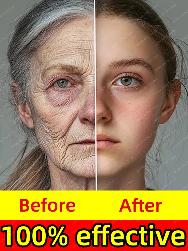 

Wrinkles Free, Youth in Every Drop