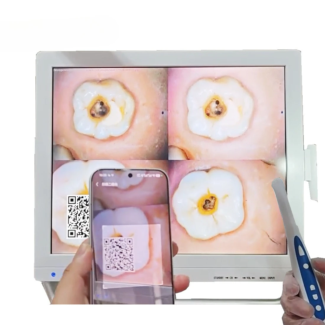 High Definition Pixel Visualization Dentals Endoscope Integrated Machine Multimedia Oral Camera Oral Observer