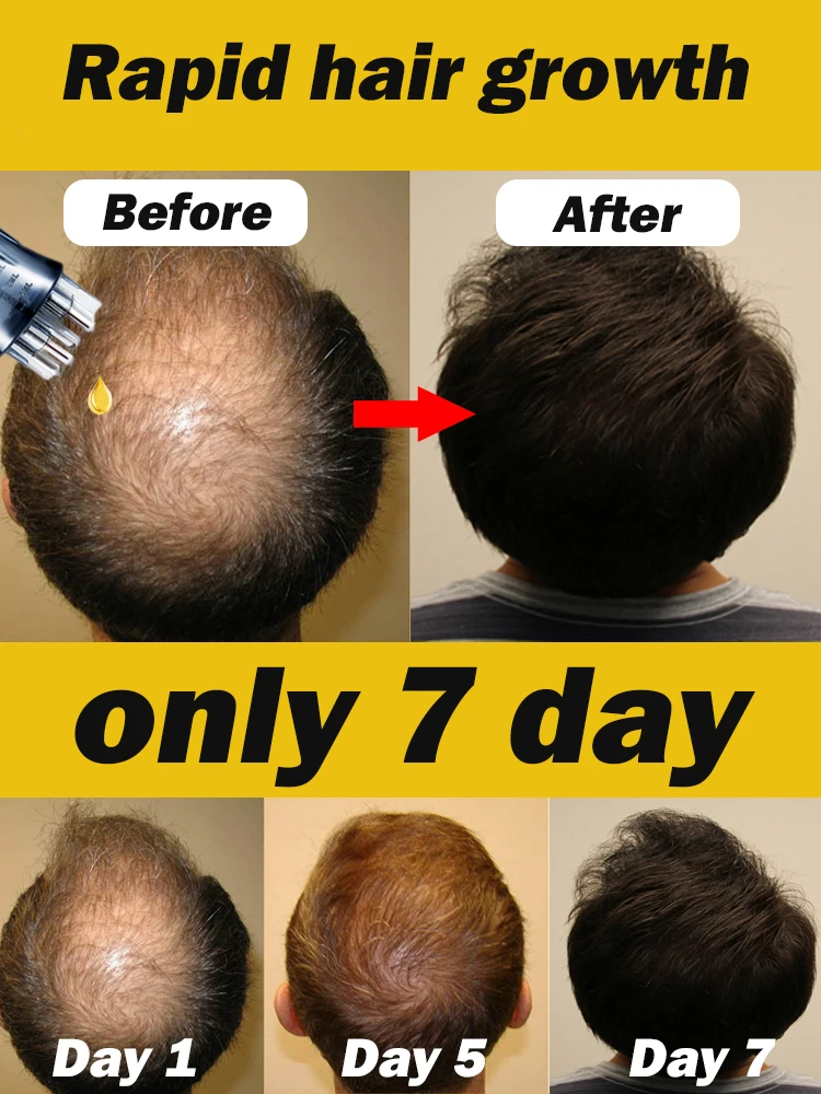 

green bottle.hair growth essential 0iI. Say goodbye to baIdness. The secret 0f thick hair hair growth serums