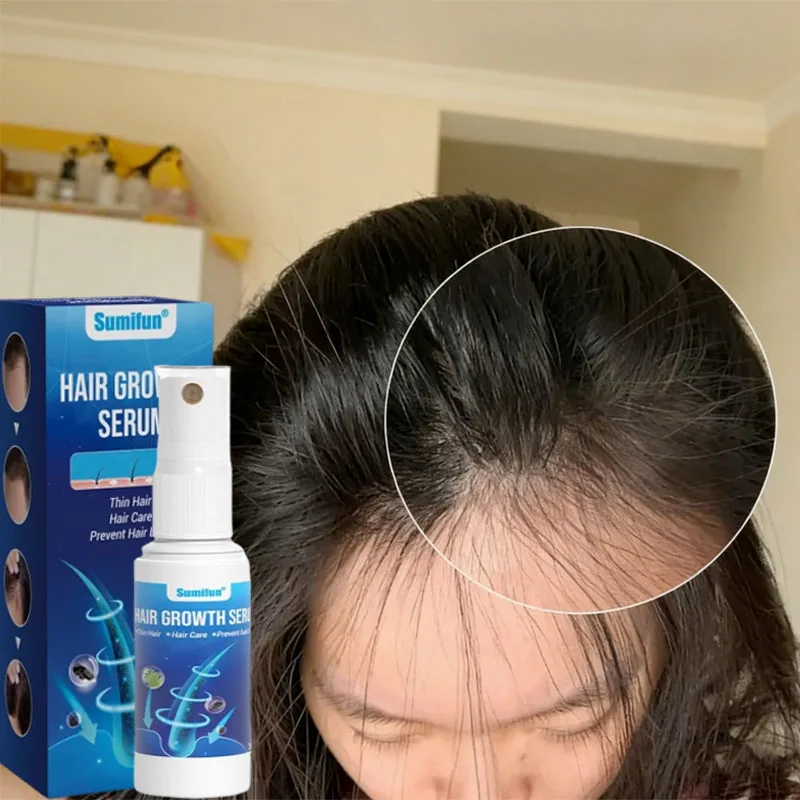 Fast Hair Growth Serum Spray Anti Hair Loss Prevent Baldness Scalp Treatment Repair Roots Beauty Health Hair Care For Men Women