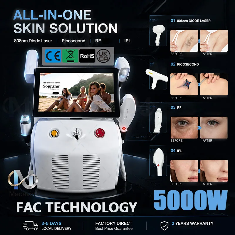 4IN1 Soprano Titanium Ice Platinum RF Diode 755 808 940 1064nm 4 Wave Laser ND:YAG Machine Painless Hair Removal Machine 4000W