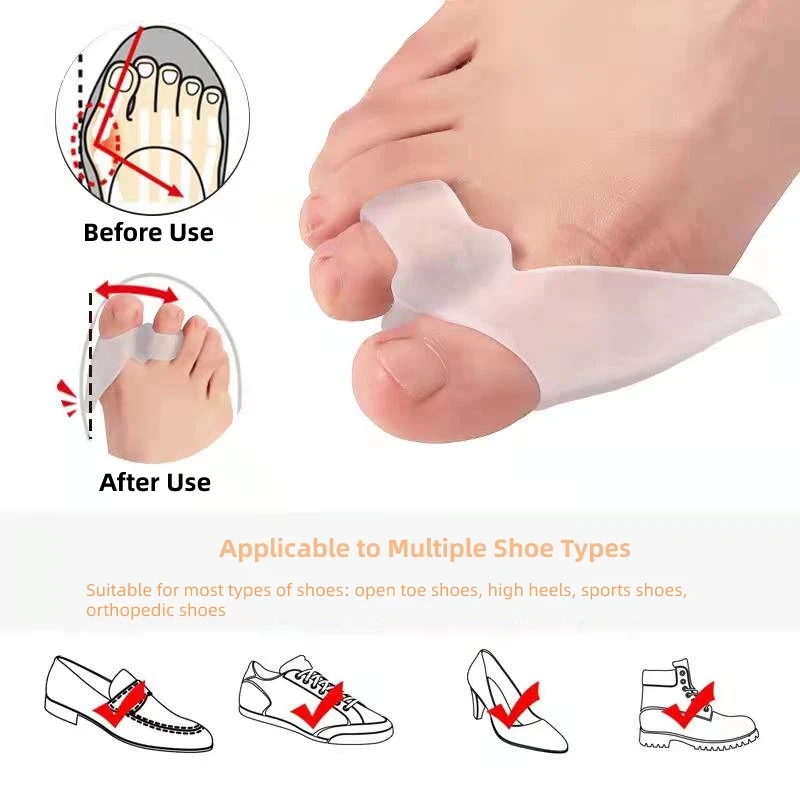 2 paia di separatori per dita in Gel di Silicone correttore per alluce del pollice barella dolore al piede alluce valgo protezione di correzione Pedicure ortopedico