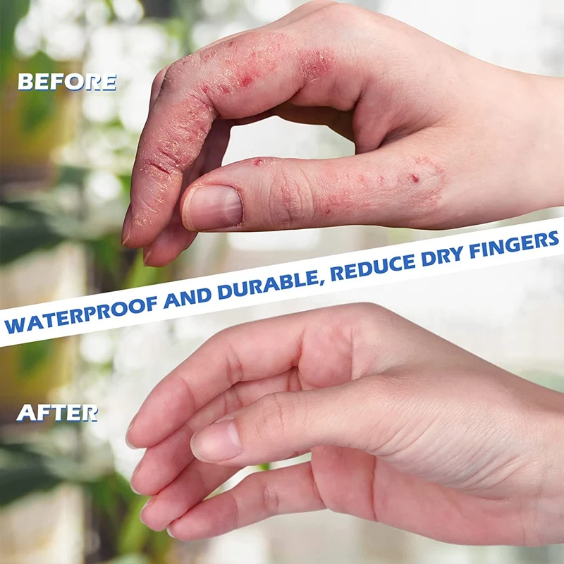 A73E-800 Pcs Poulet Latex Doigts Protection Doigts Gants Noir Anti Leges Doigts En Caoutchouc Manches