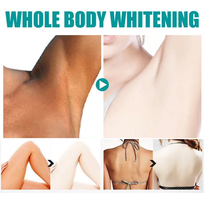 Body Whitening Oil Private Parts Underarm Bleaching Serum Whiten Butt Knee Brighten Inner Thigh Intimate Dark Remove Melanin