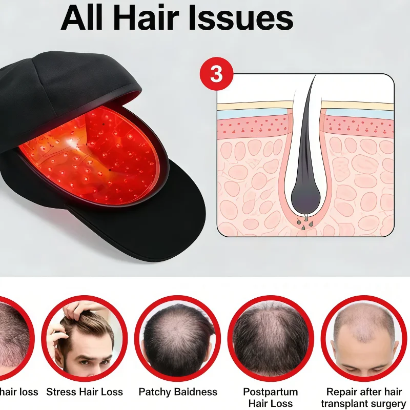 

New Upgrade96 Diodes LLLT Laser Hair Growth Cap,650nm 5mW Red Light Therapy for Scalp Care Hair Regrowth Anti Hair Loss Home Use