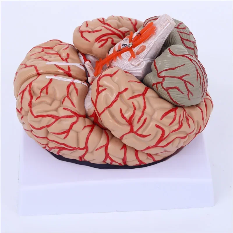 A Medical Neurology: Human Brain Anatomy Model, Cerebral Arterial Model, Detachable With Digital Brain Amplification Model