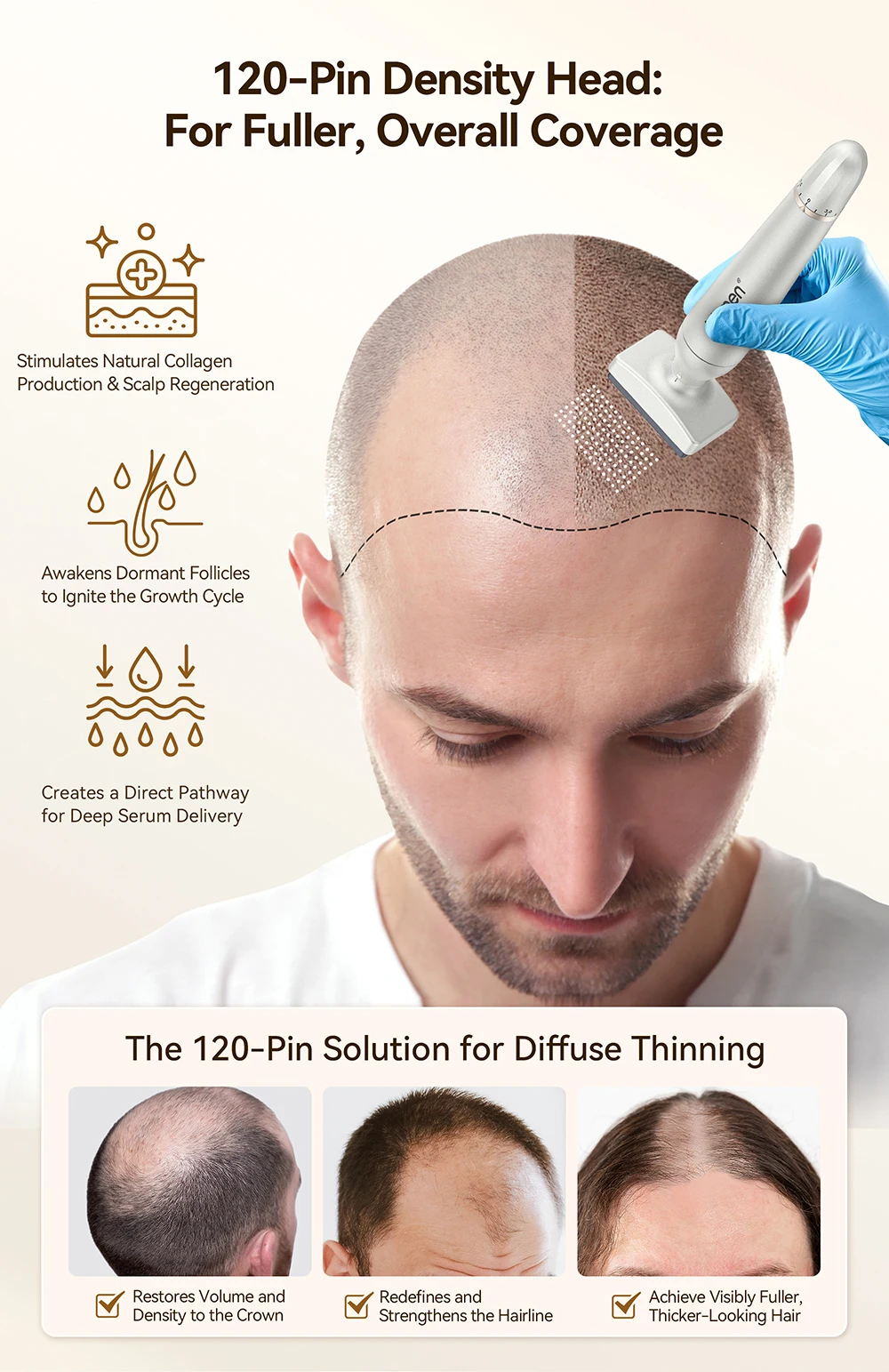 Bio 4 Derma Stamp Kit Neuerscheinung 120 Nadeln 64 Nadeln Doppelköpfiger Microneedling-Stift Edelstahlnadel Verstellbarer Derma Pen – Detail 4