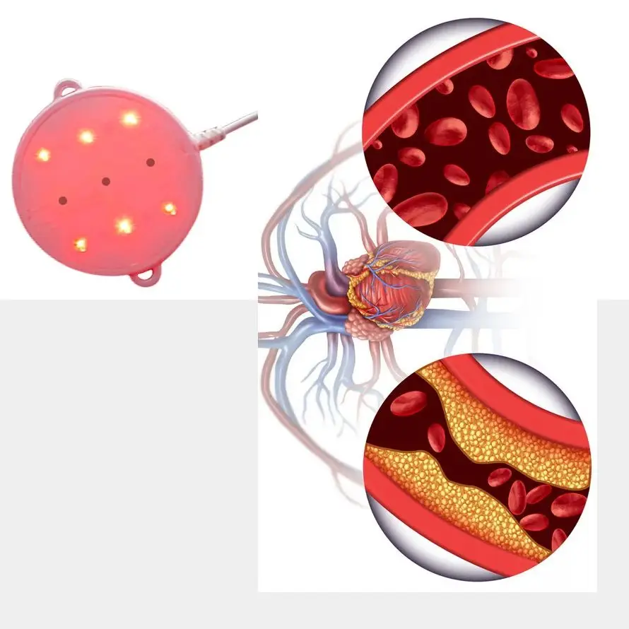 

Лазерное обезболивающее устройство 650 нм для обработки кожи глубоких тканей