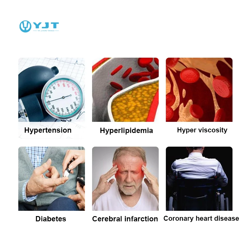 2026 YJT OEM ODM Smart Watch Hot Sale 650nm Low Level Cold Laser Therapy for Blood Pressure