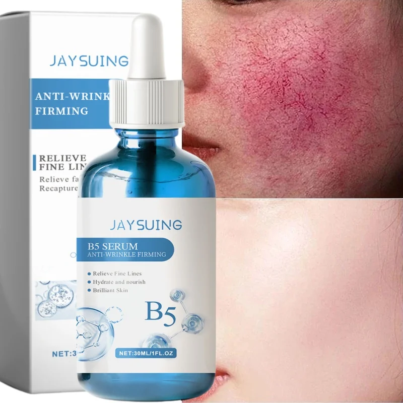 

Repair Facial Redness Serum Instant Spider Vein Remove Sensitive Skin Sooth Anti Redness Rosacea Treat Lotion Korean Cosmetics