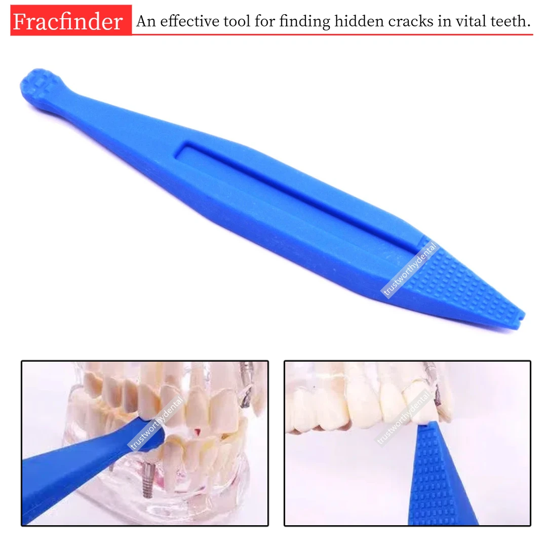 

Dental Fracfinder Tooth Slooth Fracture Detector Cleft Crack Detector Probe Explorer Crown Bridg Leocating Seater Plastic Blue
