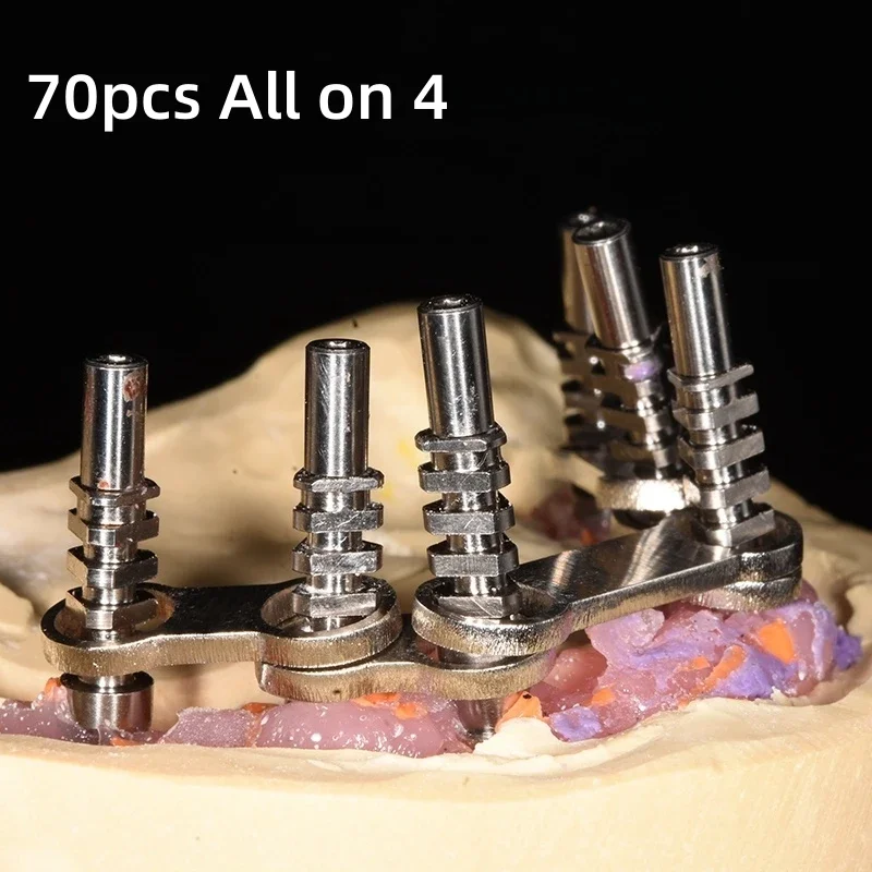 70Pcs Connecting Rods Dental Tools All on 4 Form Dental Prosthesis Metal Implant Supported Overdenture Bar 304 Stainless Steel