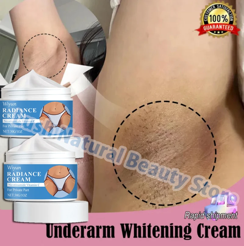 

Body Whitening Cream Bleach Underarm Elbow Knees Joint Melanin Remove Brighten Inner Thigh Private Parts Moisturizer Body Lotion