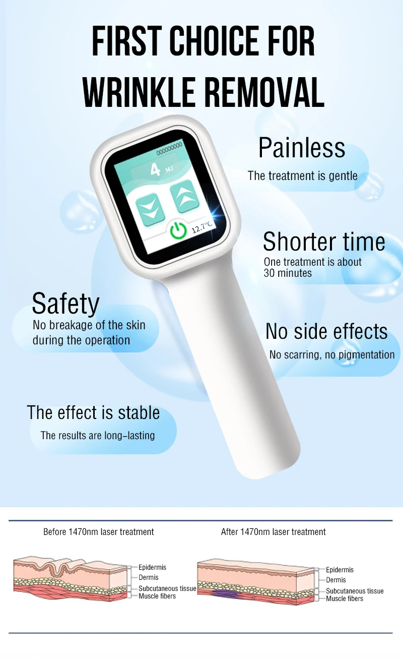 New Arrival 1470nm Portable Fractional Laser Facial Repair Wrinkle Removal Skin Tightening Anti Wrinkle 1470nm Machine