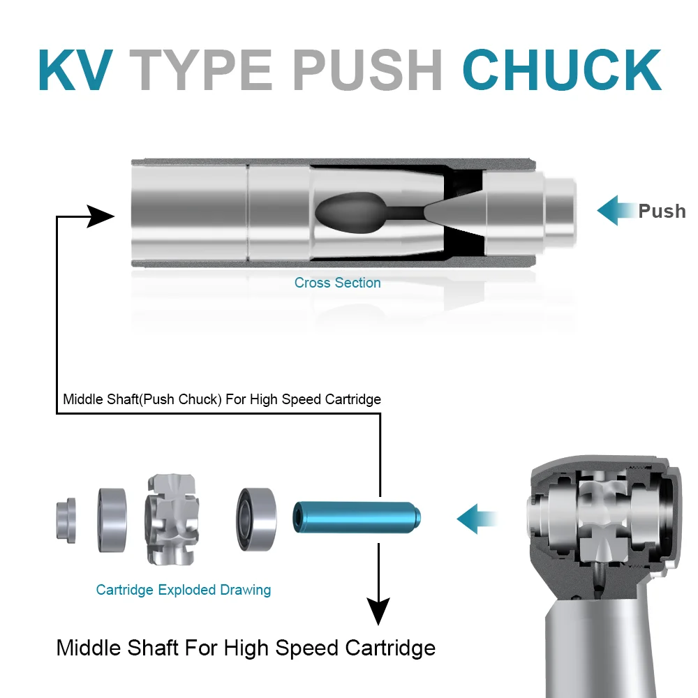 AI-S-KV wszystkie wielkości uchwyty dentystyczne wpush środkowy wał szybkiego powietrza turbina części zamienne