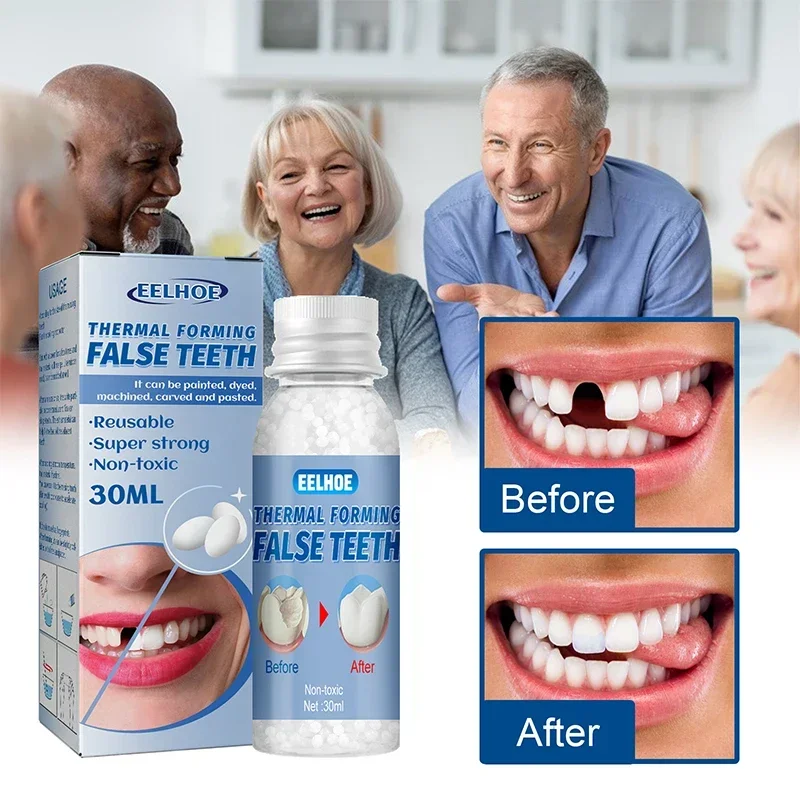 Denture Filling Care Kit, Thermal Forming False Teeth Repair Beads, Shapeable Dental Adhesive, Dental Particles Fix Broken Tooth