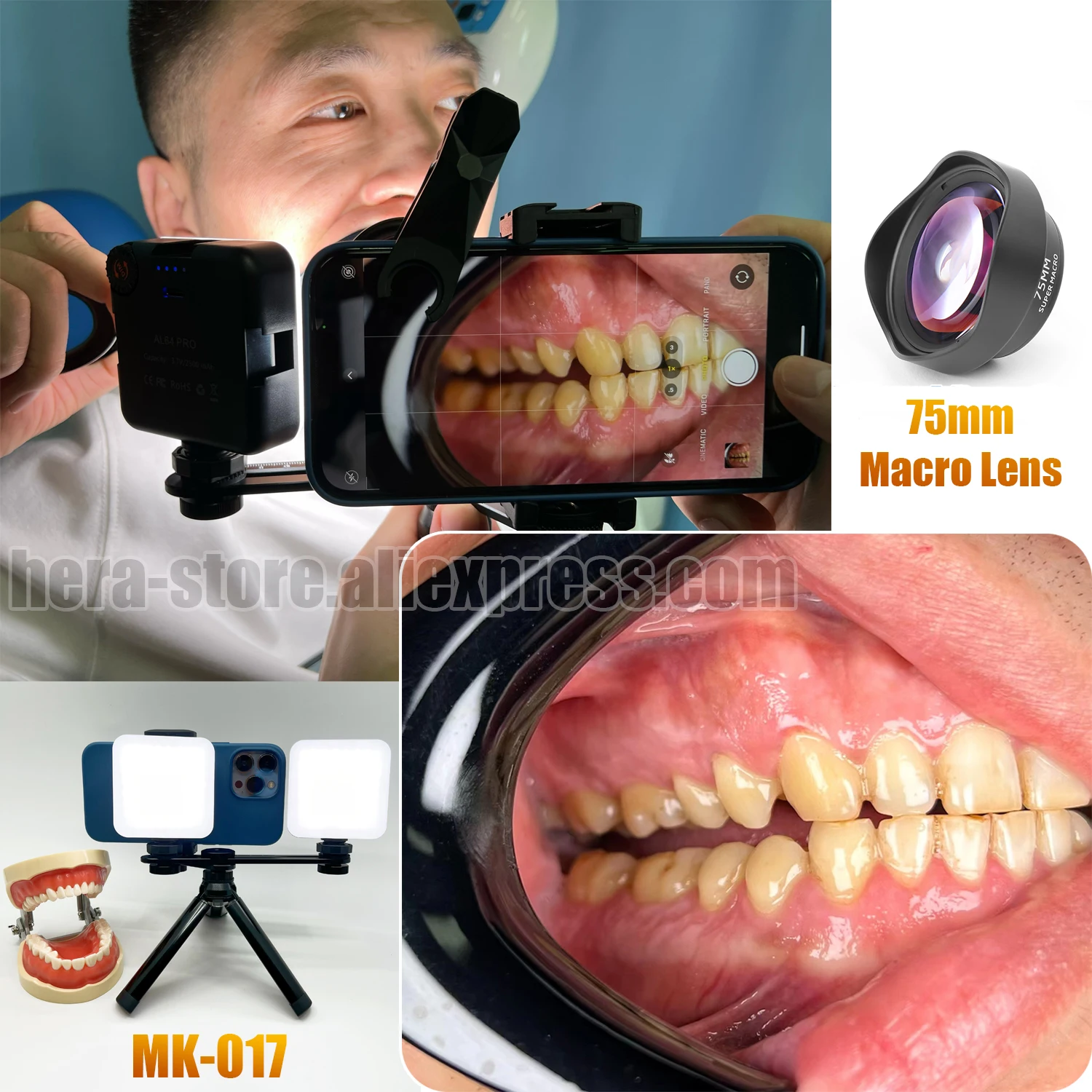 Dental Photography Light with Bluetooth And Tripod, Dentistry Treatment Oral Filling Light for Dentists, Dental Photo Lamp. MK17