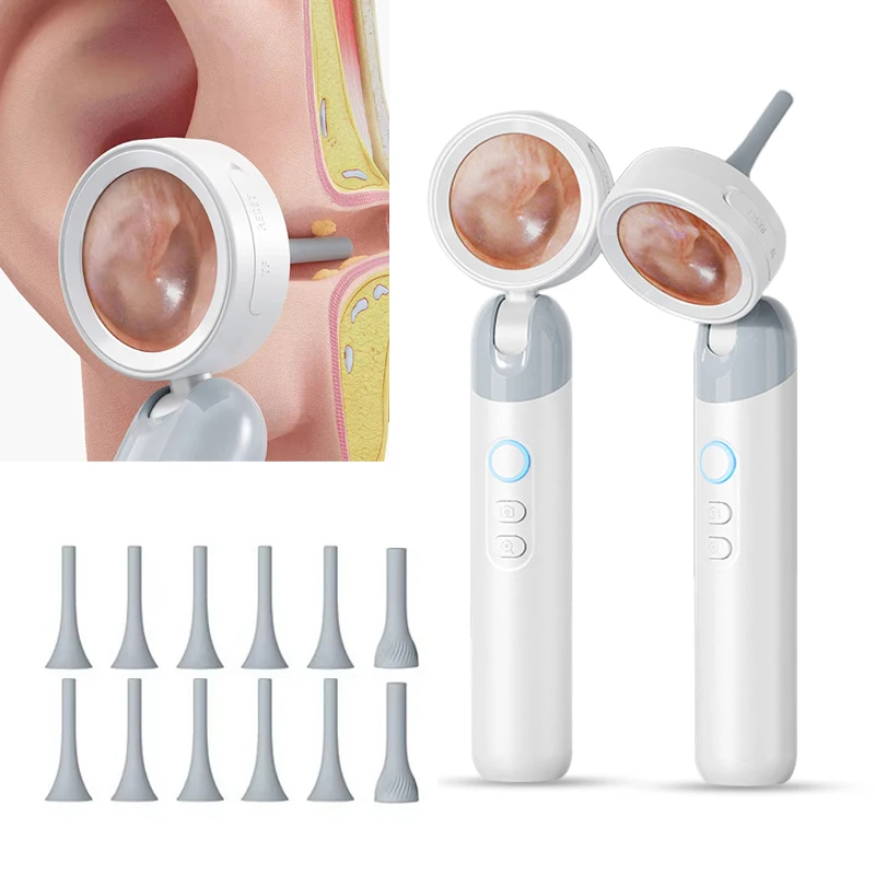Ear Care 1080P HD Digital Visual Camera Endoscope Smart Cleaning Detector Smart Scopes with Screen Spoon & Silicone Speculum B2