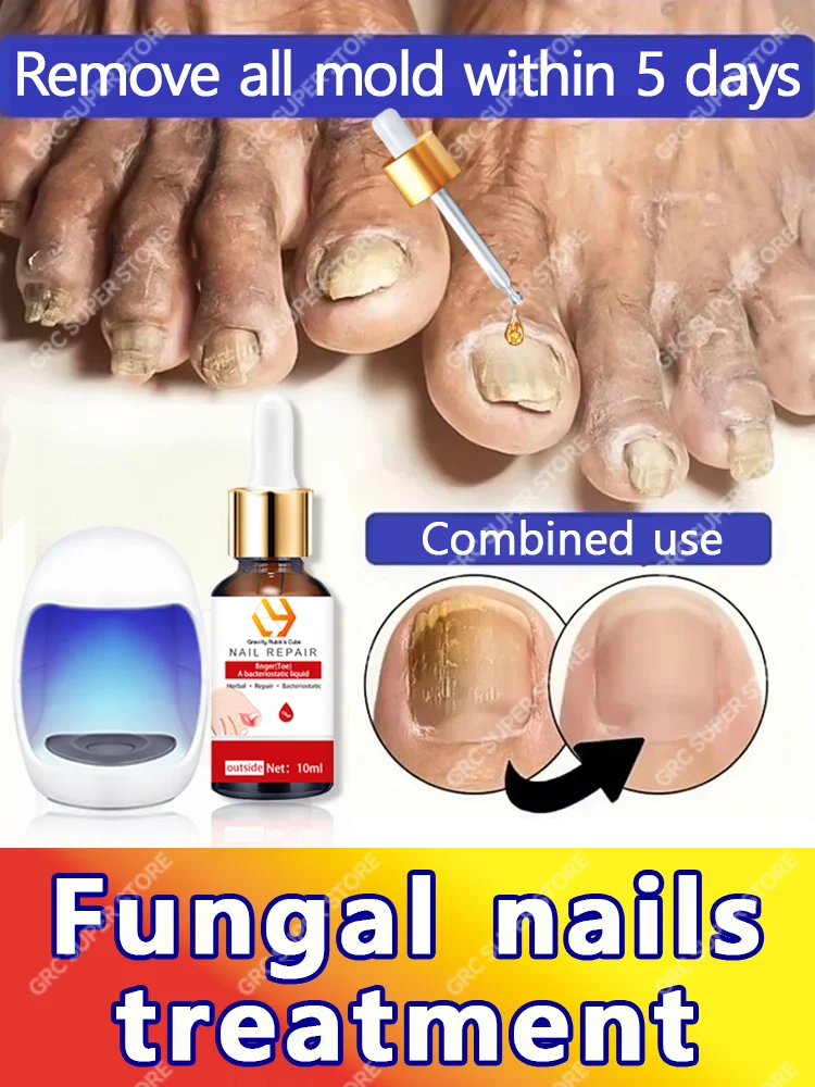

Leg nail care to give you a perfect pair of nails