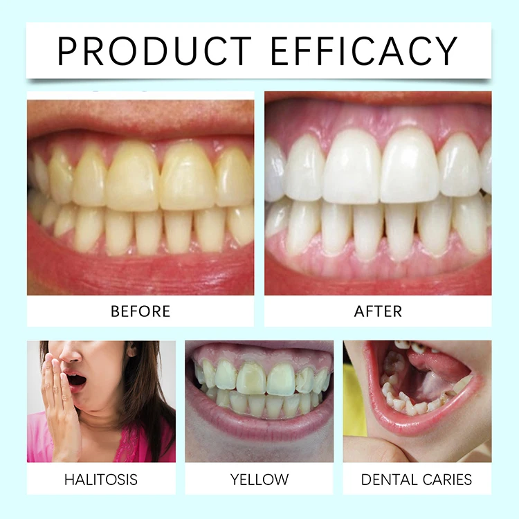 5 boxes minimum order, coconut oil cleaning toothpaste, deep cleansing oral care sticker, can be customized with its own brand