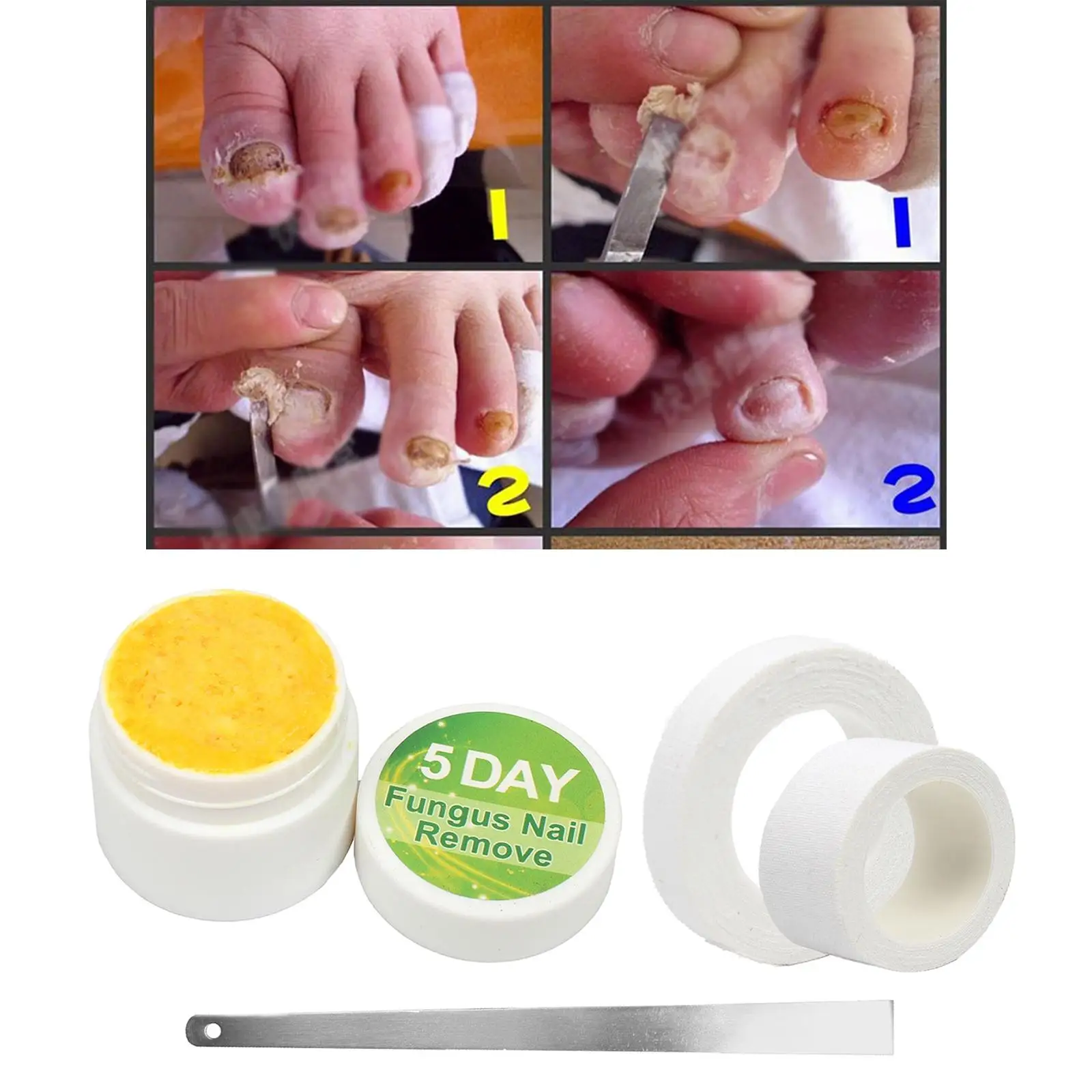 20g Anti Fungus Nail Fungus Treatment Cream Paronychia Anti Fungal Nail Treatments Nail Repair Liquid Foot Care Tools