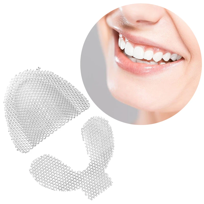 Bandejas de metal para impressão dentária, aço inoxidável, malha de reforço dentário, retenção palatina para dentes superiores, dentes superiores e inferiores, 40pcs