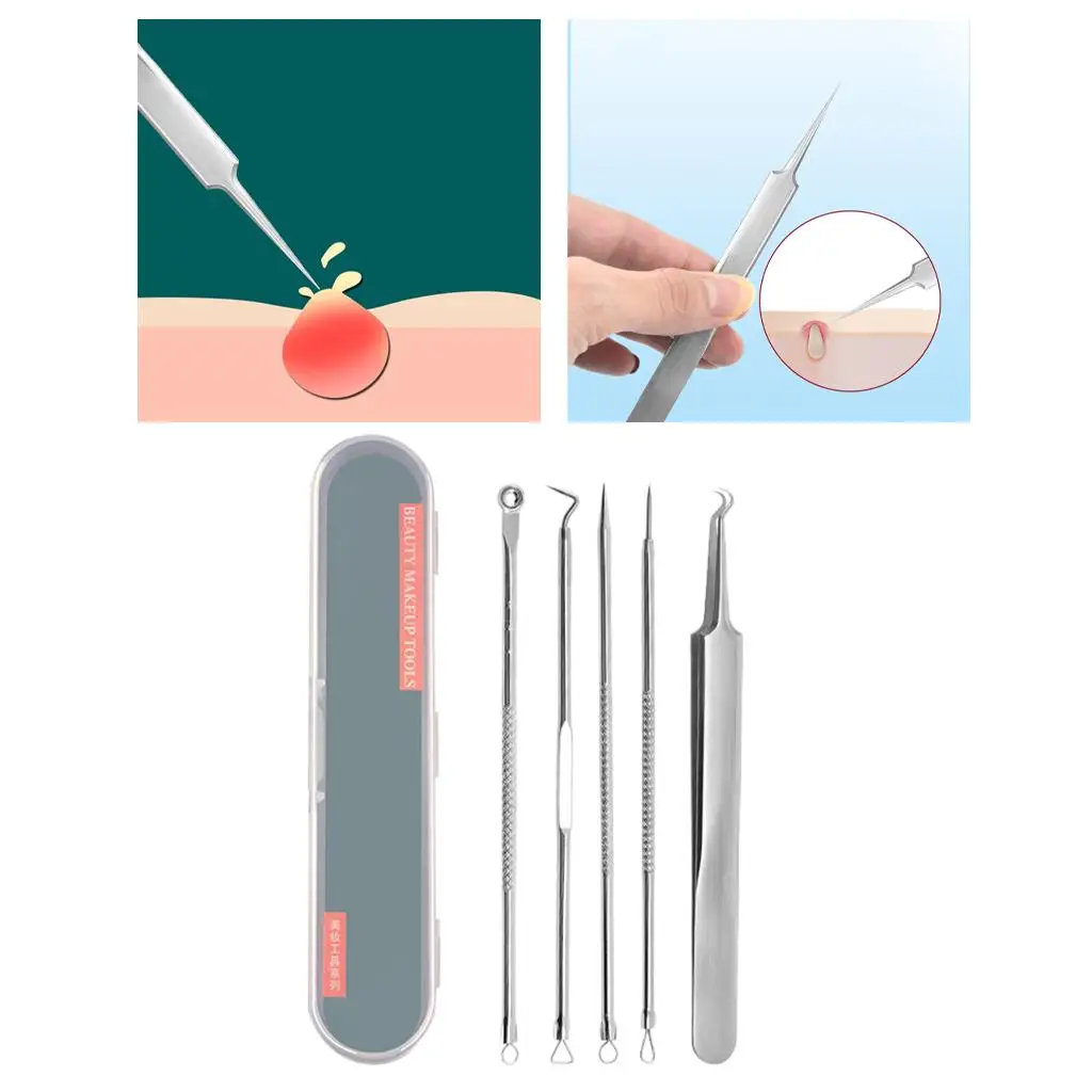 2-4pack Acne Blackhead Removal Extractio for Zit Removing Whitehead