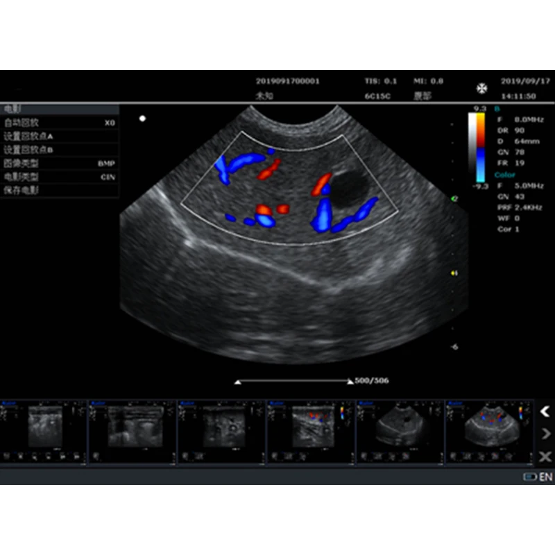 HF-K10 mindray ultrasound machine veterinary ultrasound equipment on sale