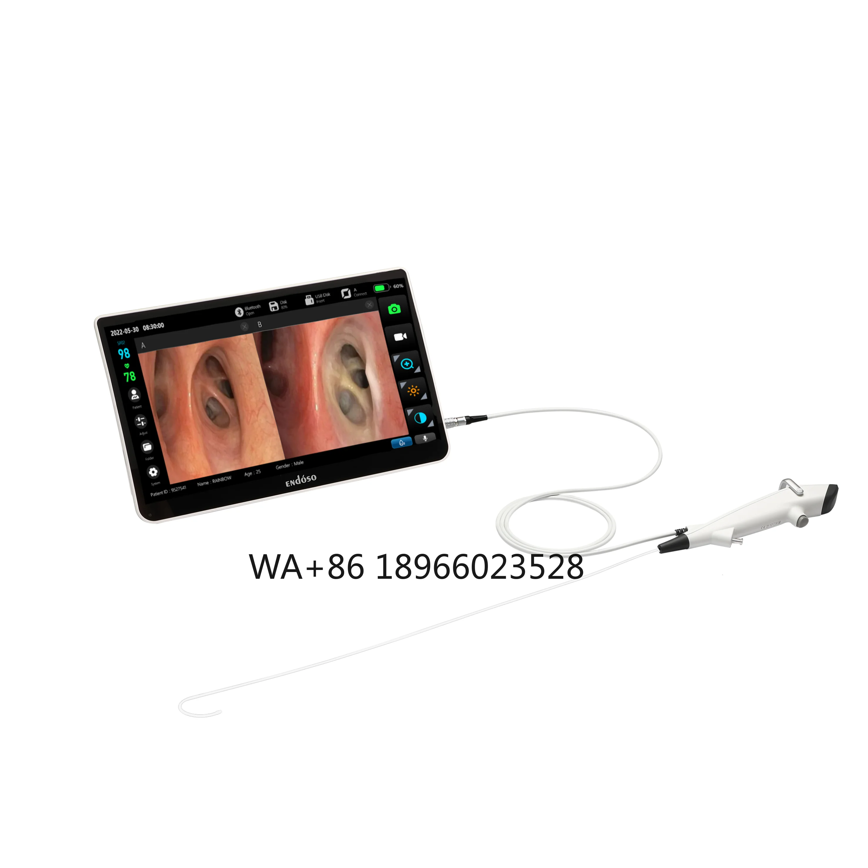 12.1 Inch Disposable Flexible Laryngoscope Gastroscope Rhinoscope Bronchoscope Endoscope  Medical Image Processor