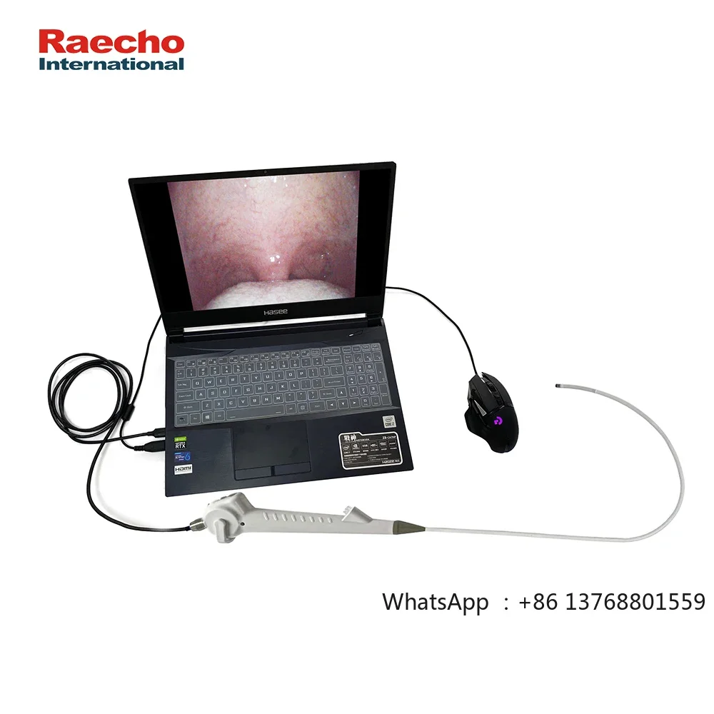 Disposable Video Ureteroscope ENT Ureteroscope Flexible Video Endoscope Digital Urological Ureteroscope 2.8mm