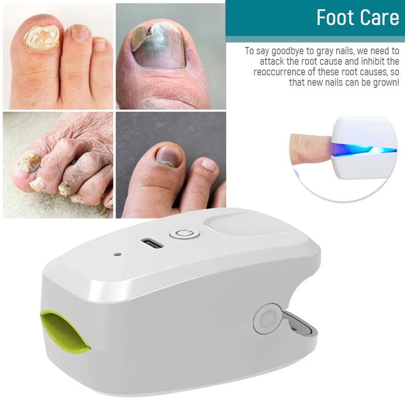 905NM Nail Therapeutic Instrument Portable Painless Nail Laser Therapy Device Anti-Slip Silicone Durable Easy To Use White