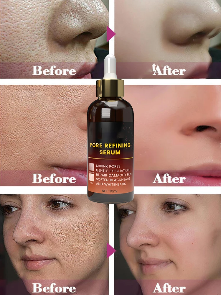 Effective Pores Remover Pore Shrinking Serum Shrink Tightening Minimizing  Serum Facial  Skin Care Products Acne Treatment