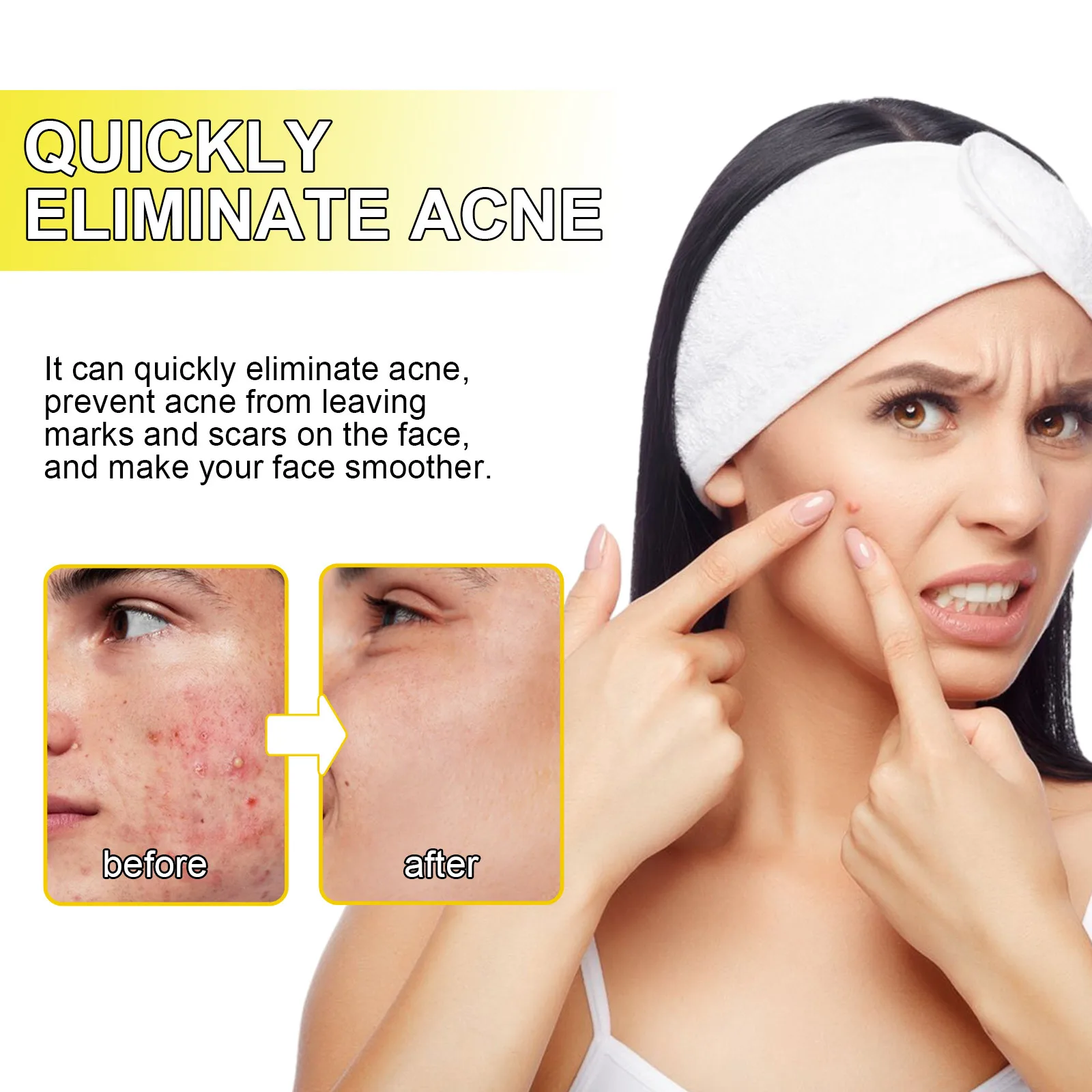 Cleansing Facial Acne Acne Closing Blackhead Removal Delicate Skin Acne Patch